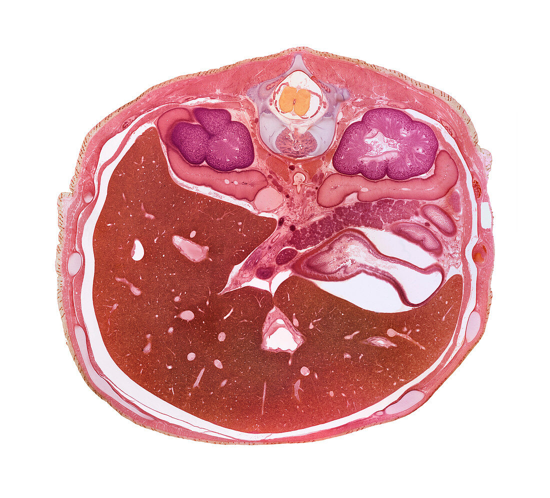 Foetal liver