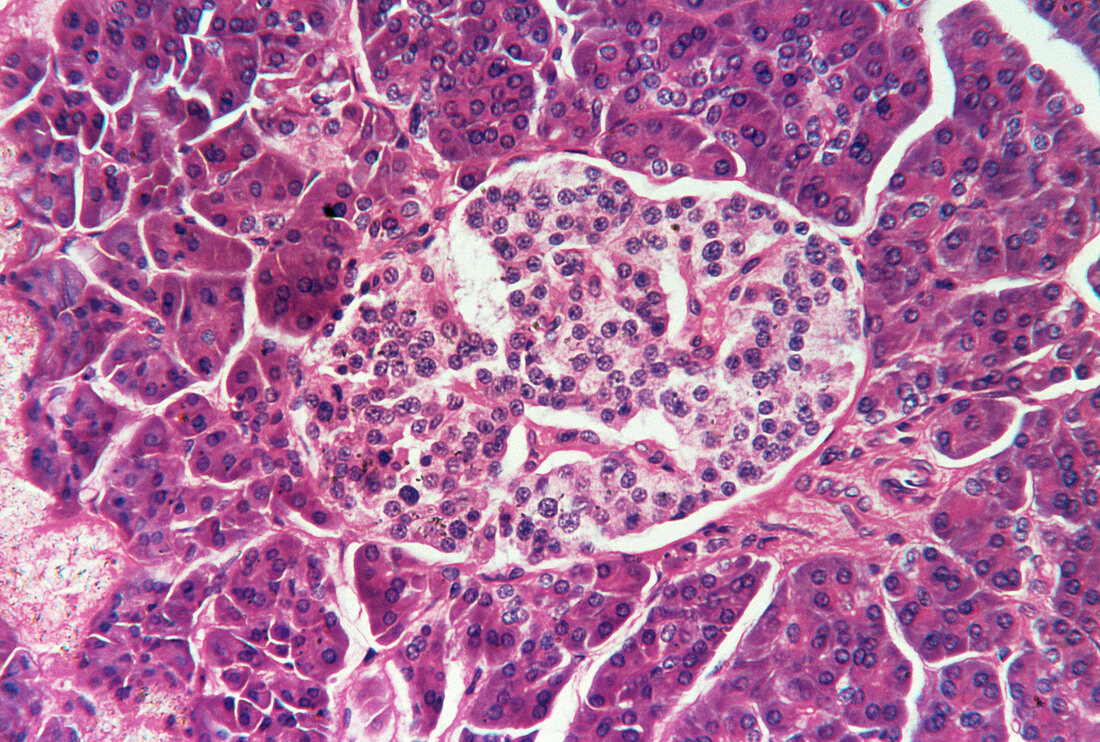 LM of the pancreas showing the Islet of Langerhans