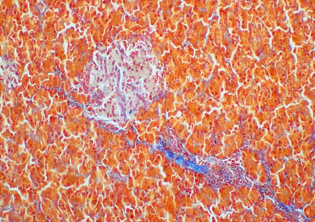 Light micrograph of a section of human pancreas