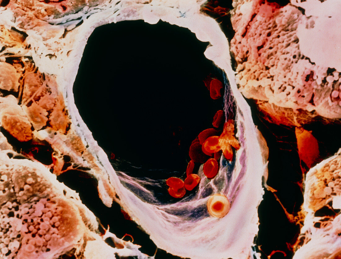 Coloured SEM a small vein in pancreatic tissue