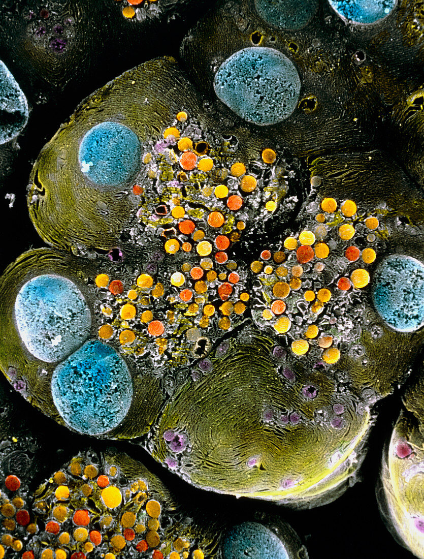 Coloured SEM of a pancreatic acinus (cell group)