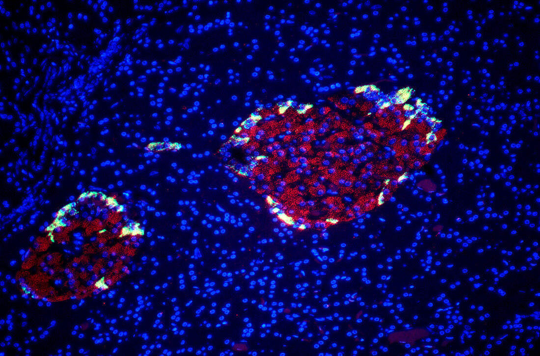 Pancreatic cells,fluorescent micrograph