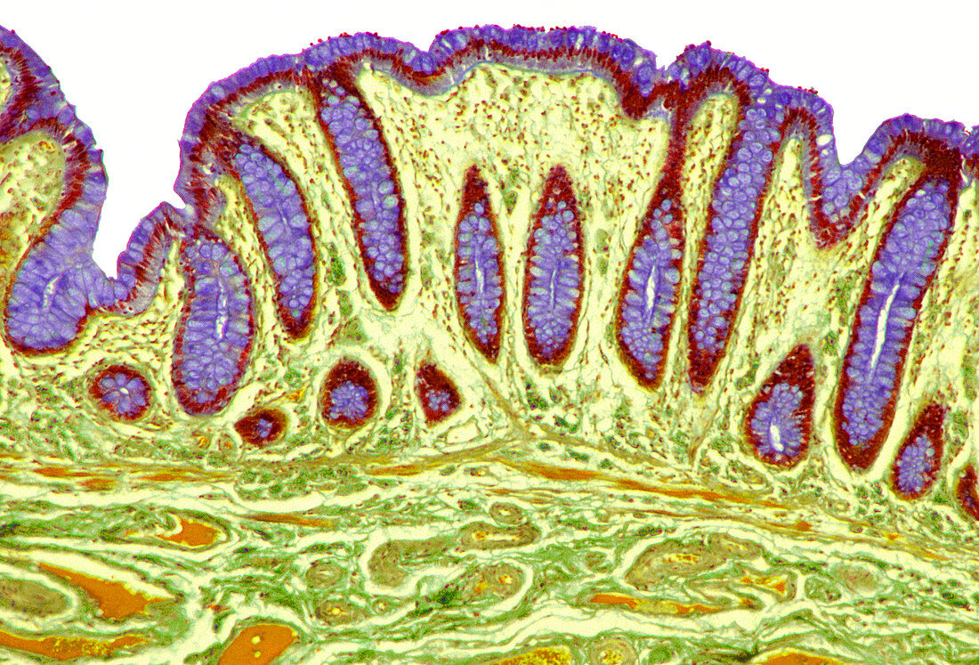 Colon lining,light micrograph
