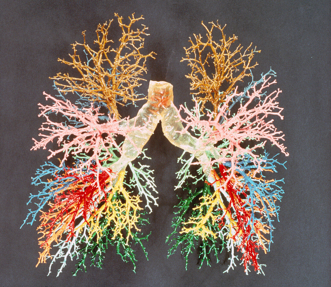 Resin cast of the airways of the human lungs