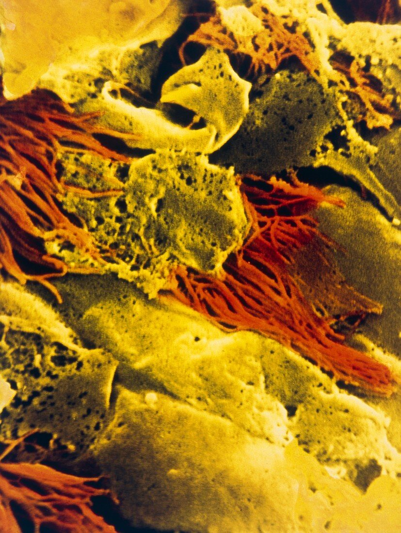 False-colour SEM of human bronchial epithelium