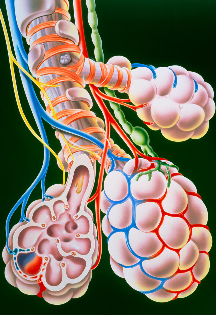 Illustration of lung bronchioles and alve