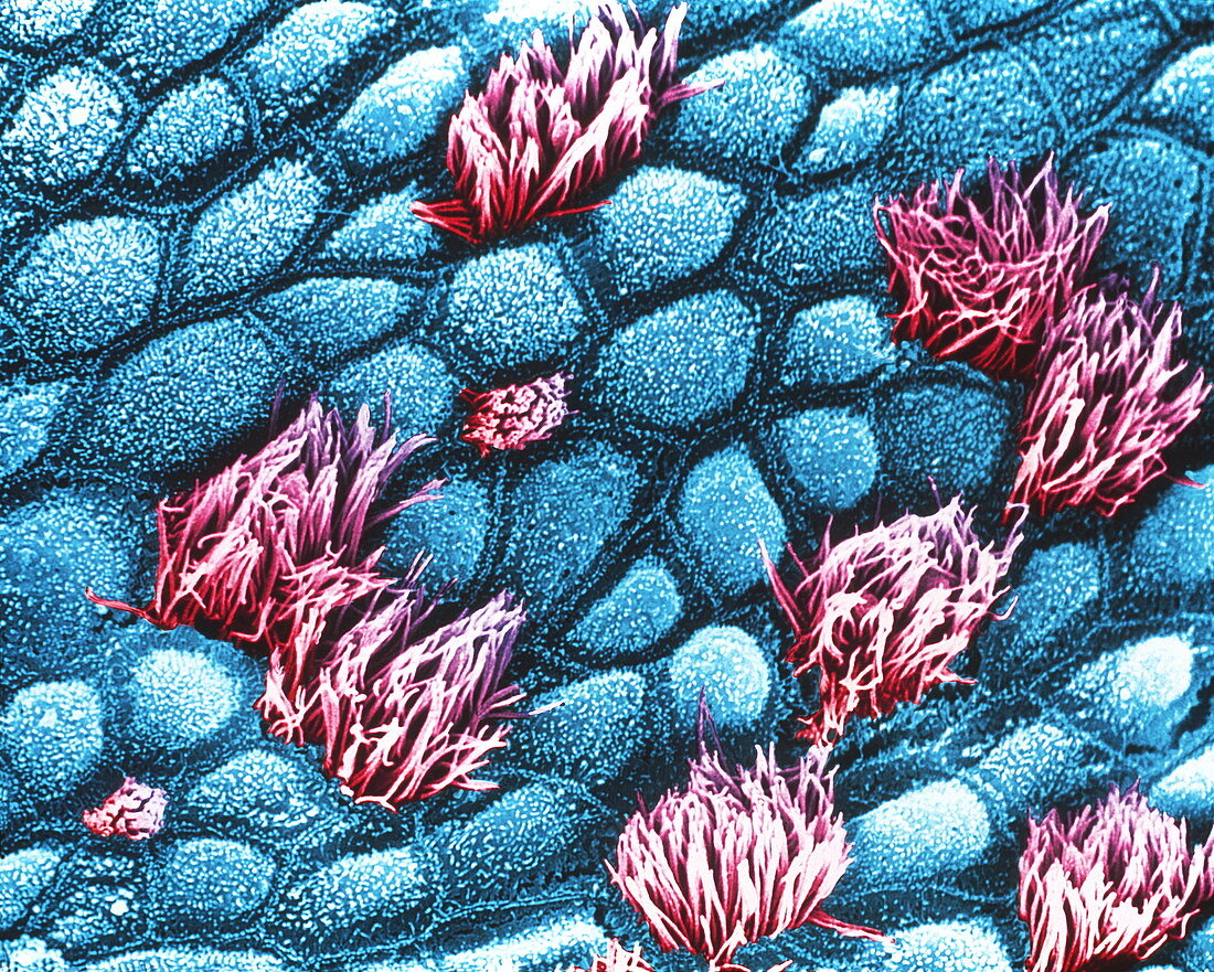 Coloured SEM of human tracheal epithelium