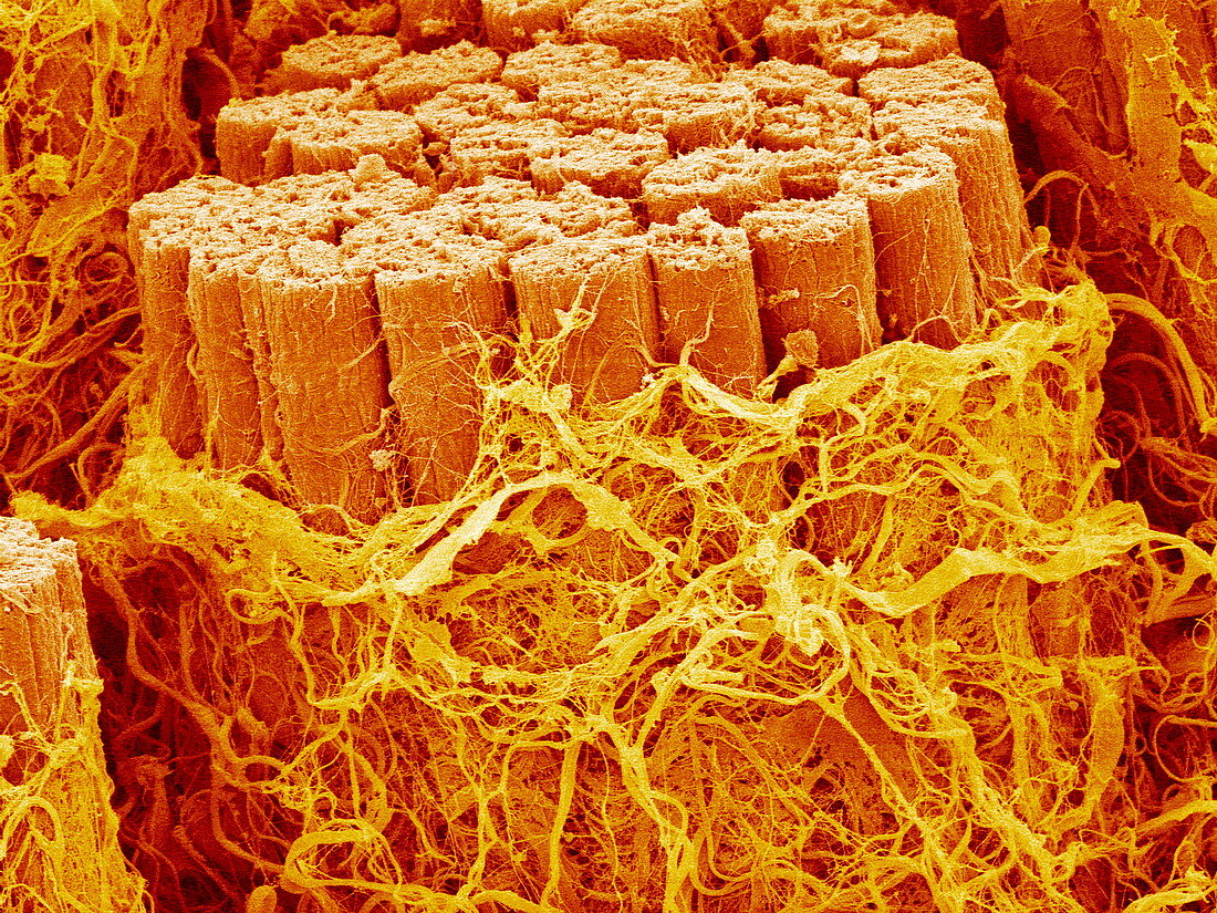 Trachea muscle,SEM