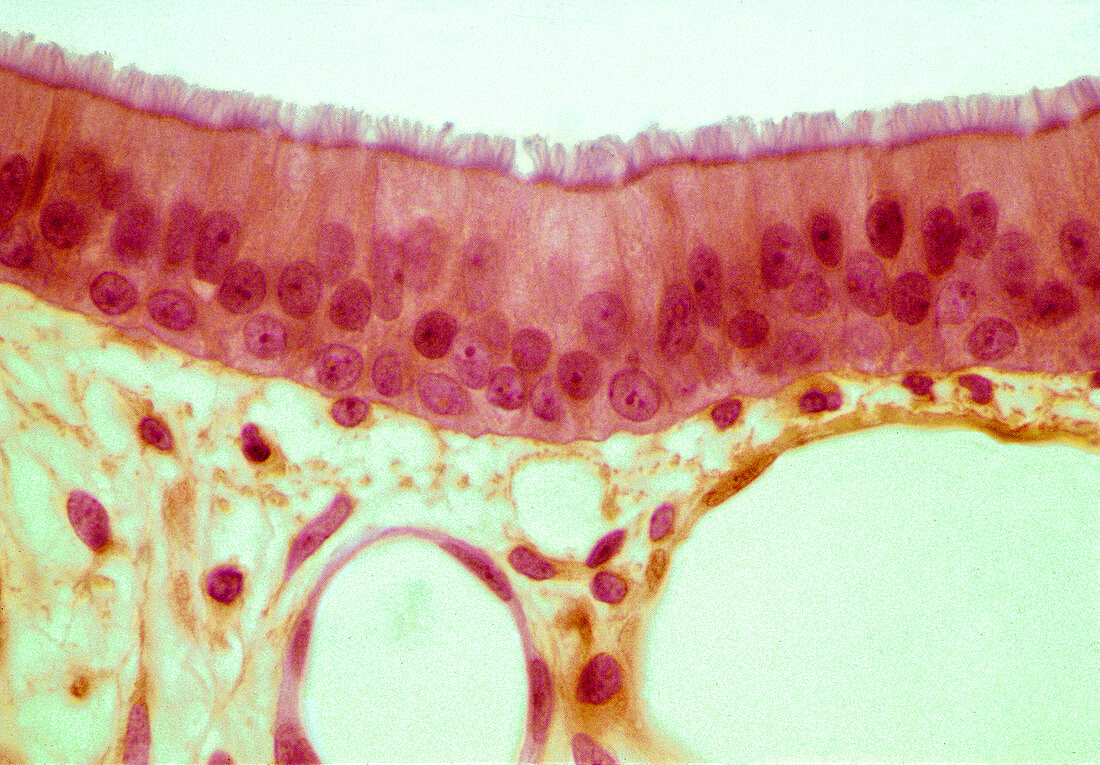 Trachea epithelium,light micrograph