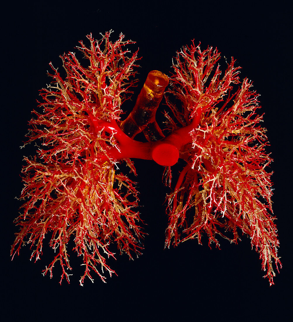 Resin cast of the airways & arteries of the lungs