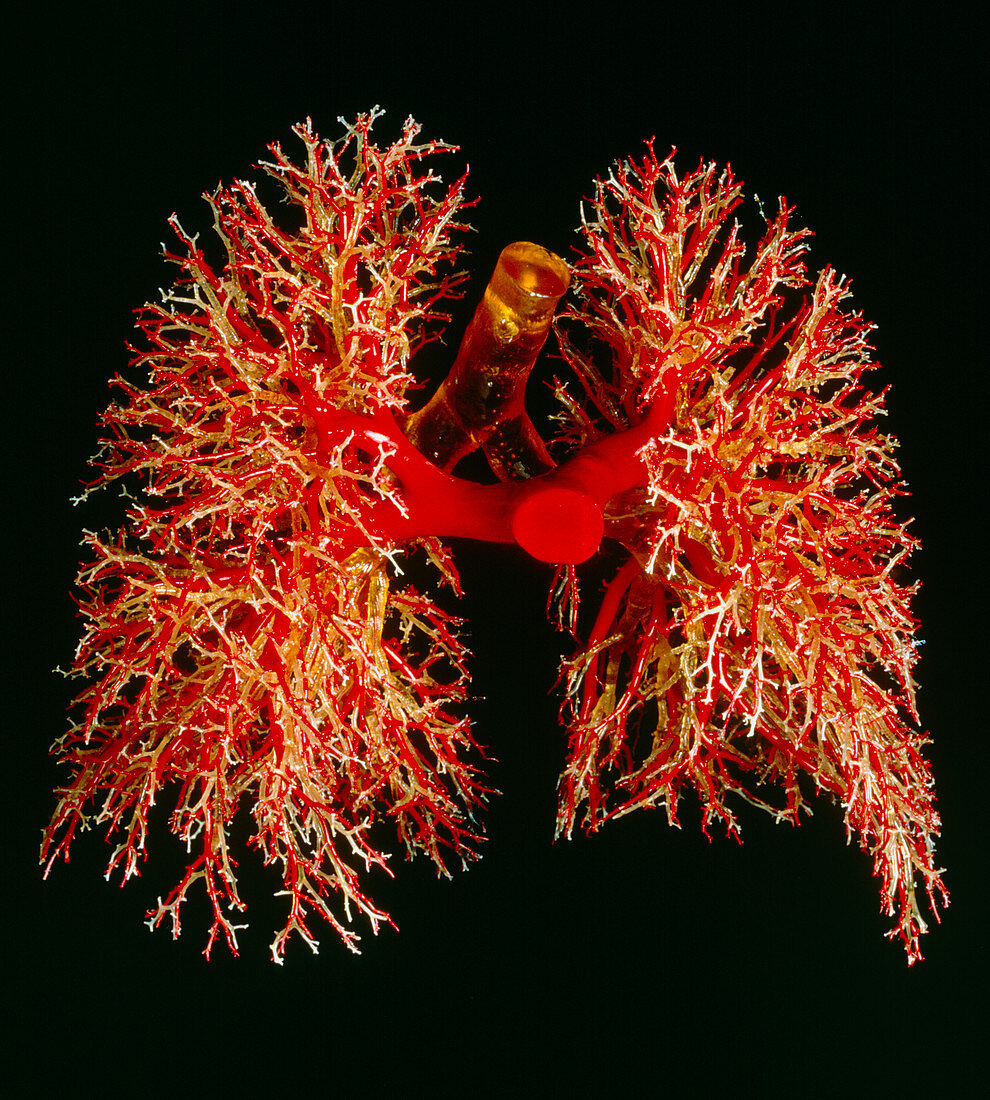 Resin cast of pulmonary arteries and bronchi