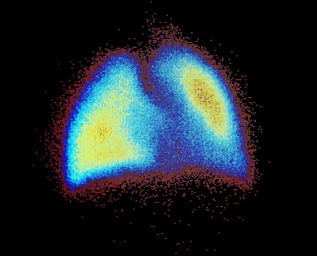 F/col scintigram of normal human lungs