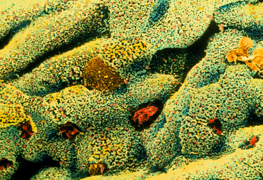 Colour SEM of goblet cells on large intestine wall