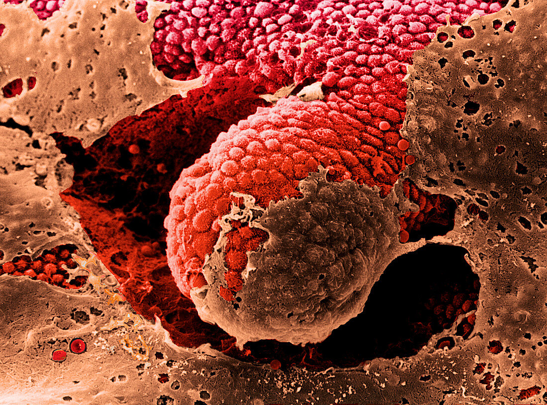 Coloured SEM of the mucosa of the large intestine