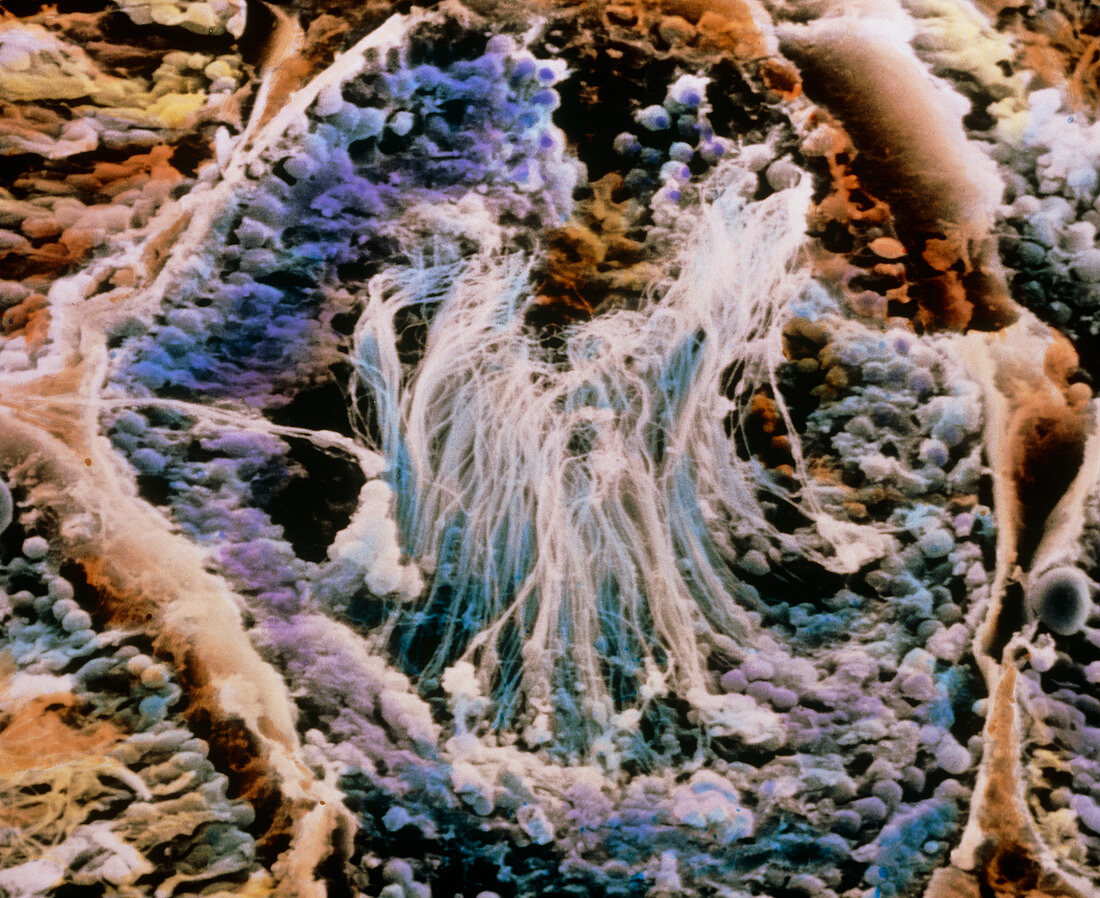 Coloured SEM of a seminiferous tubule