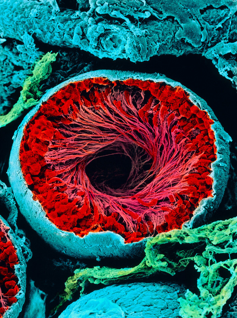 Colour SEM of seminiferous tubule of the testis