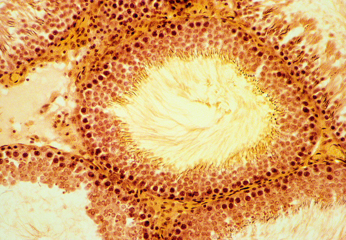 Seminiferous tubule,light micrograph