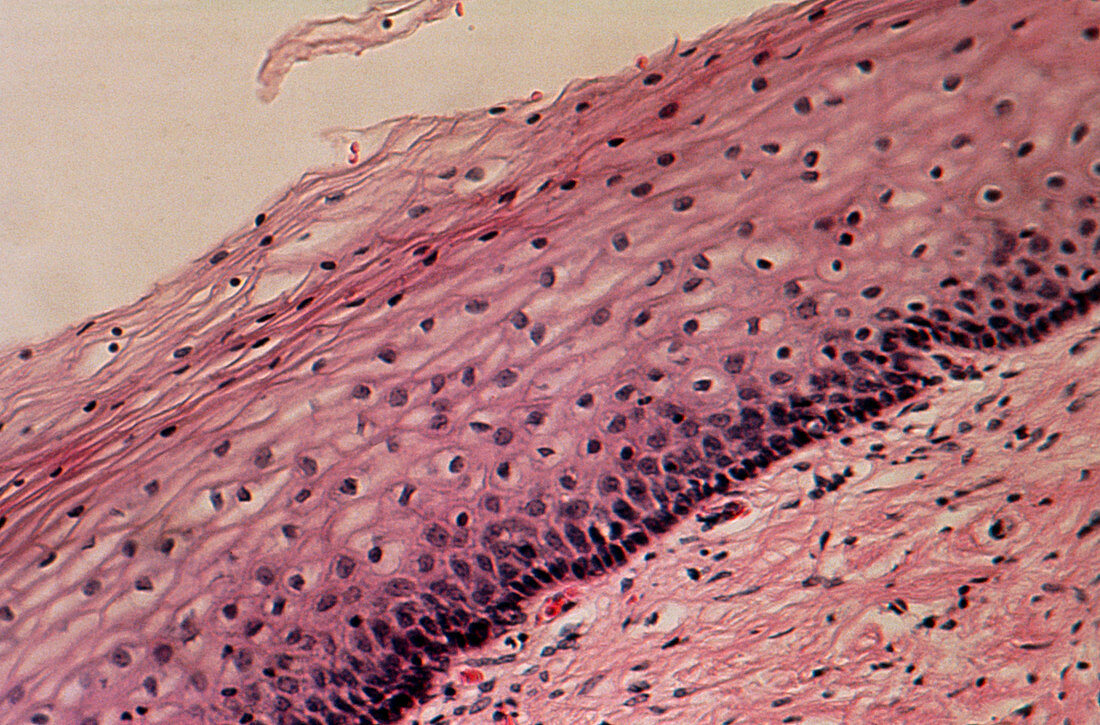 LM of a section of the normal human extocervix