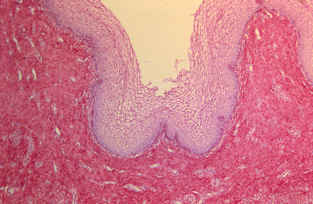Light micrograph of vaginal mucosa