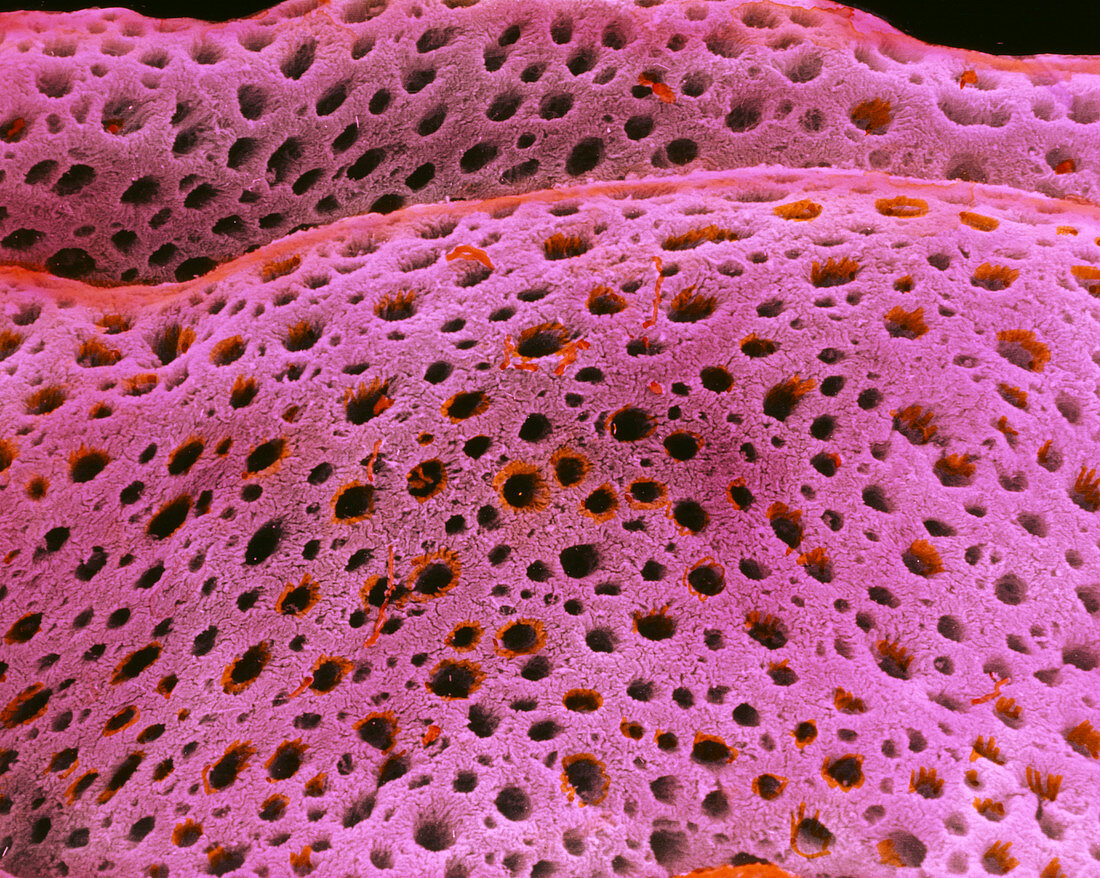 Coloured SEM of the uterus endometrium at oestrus