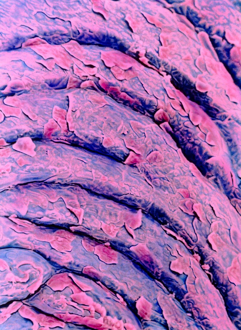 Colour SEM of cells shedding on vaginal epithelium