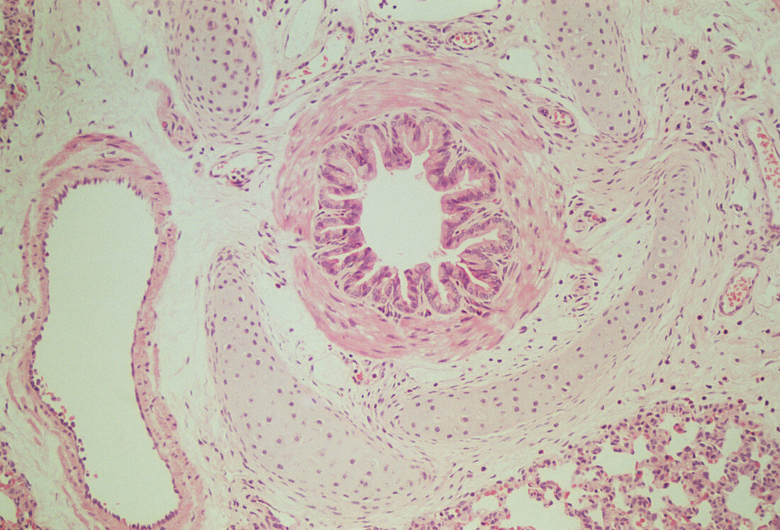 LM of a cross section through a bronchiole in lung