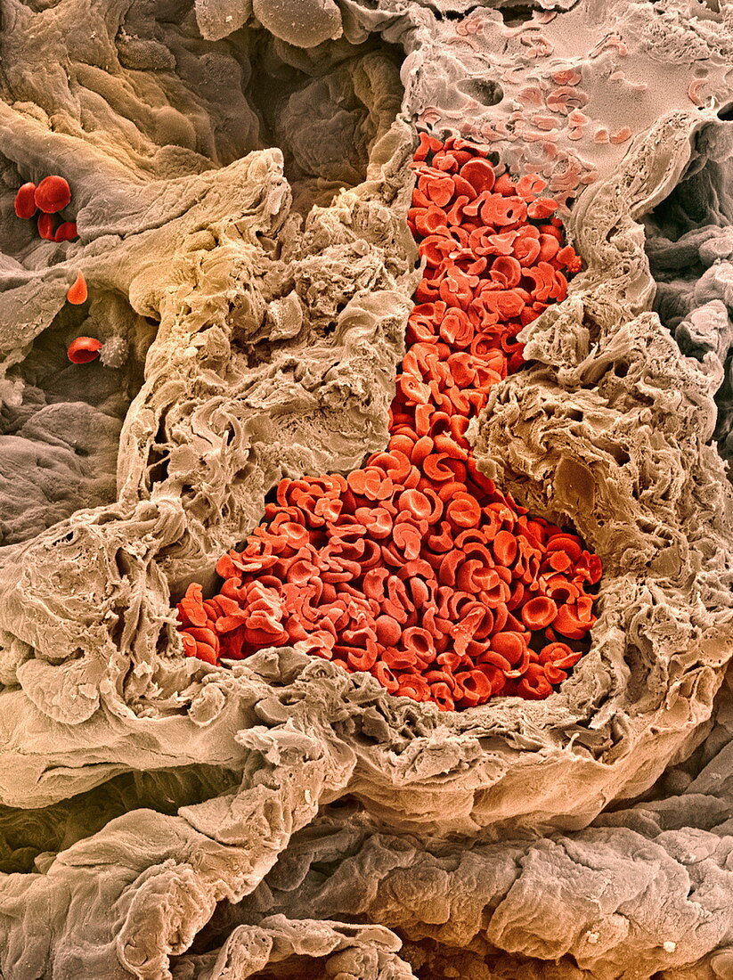 Lung blood vessel,SEM