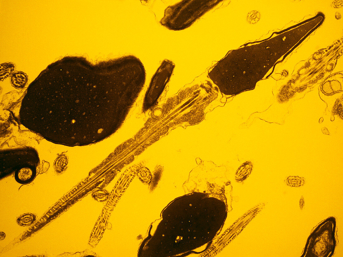 False-colour TEM of single human spermatozoan