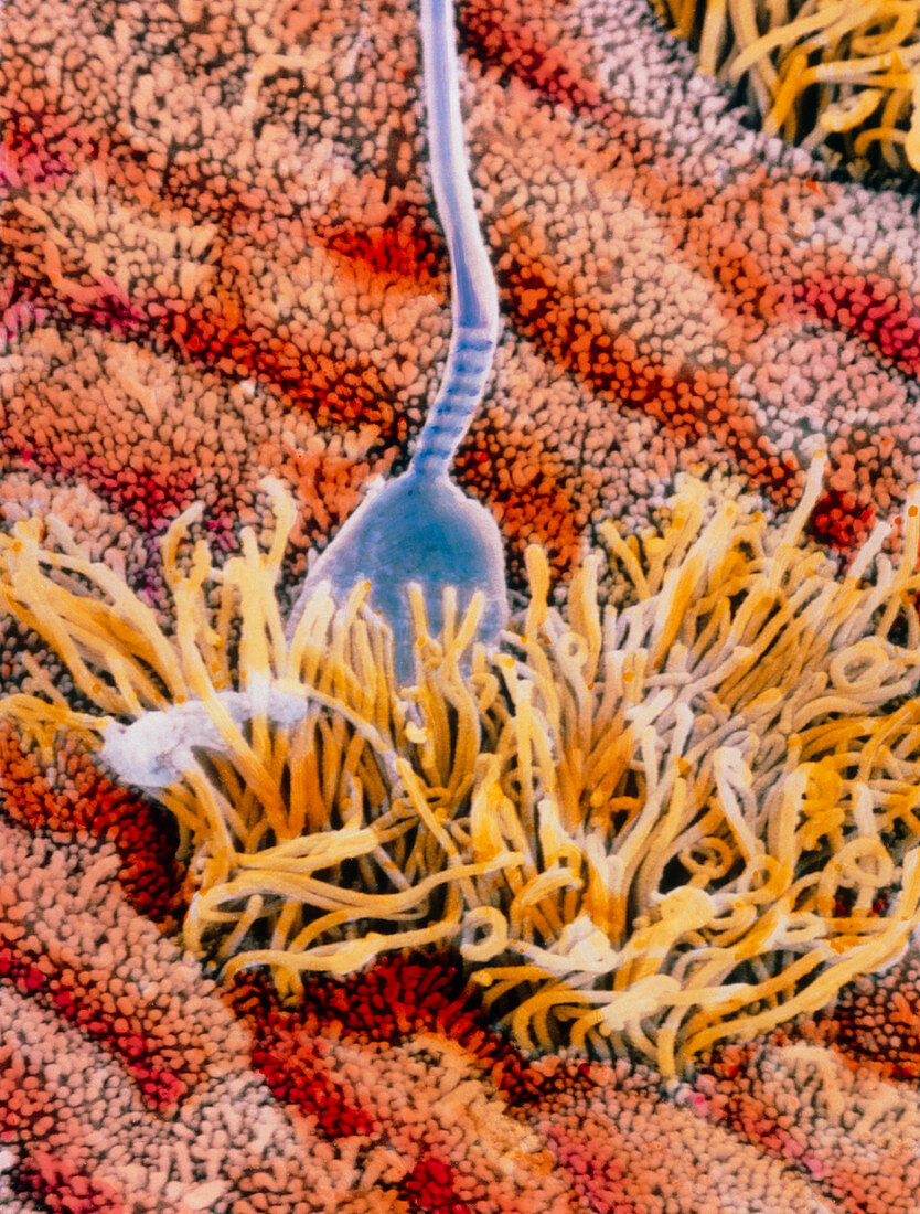 False-colour SEM of sperm in uterus