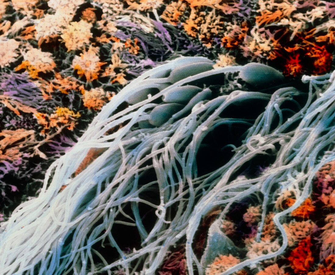False-colour SEM of sperm in cervical canal