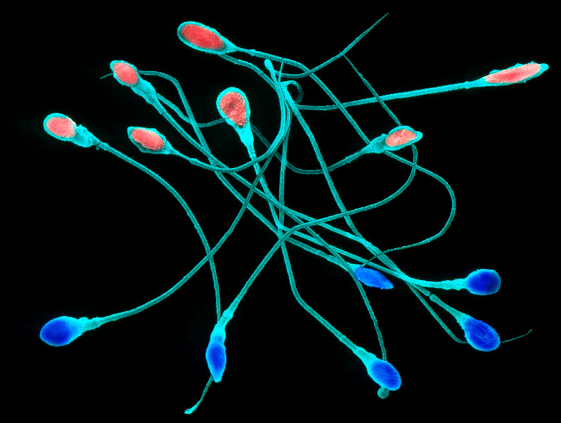 SEM of human sperm male and female types