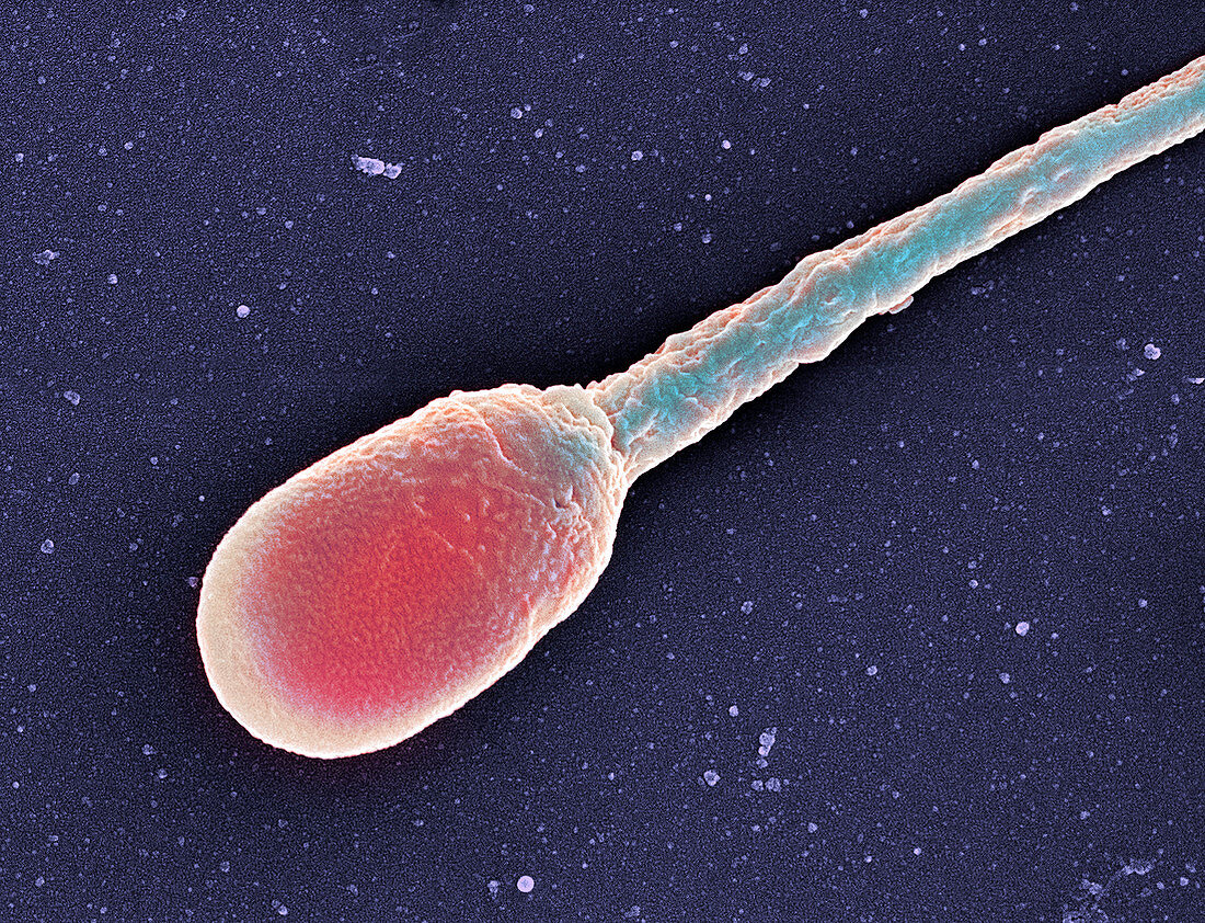 Human sperm cell,SEM