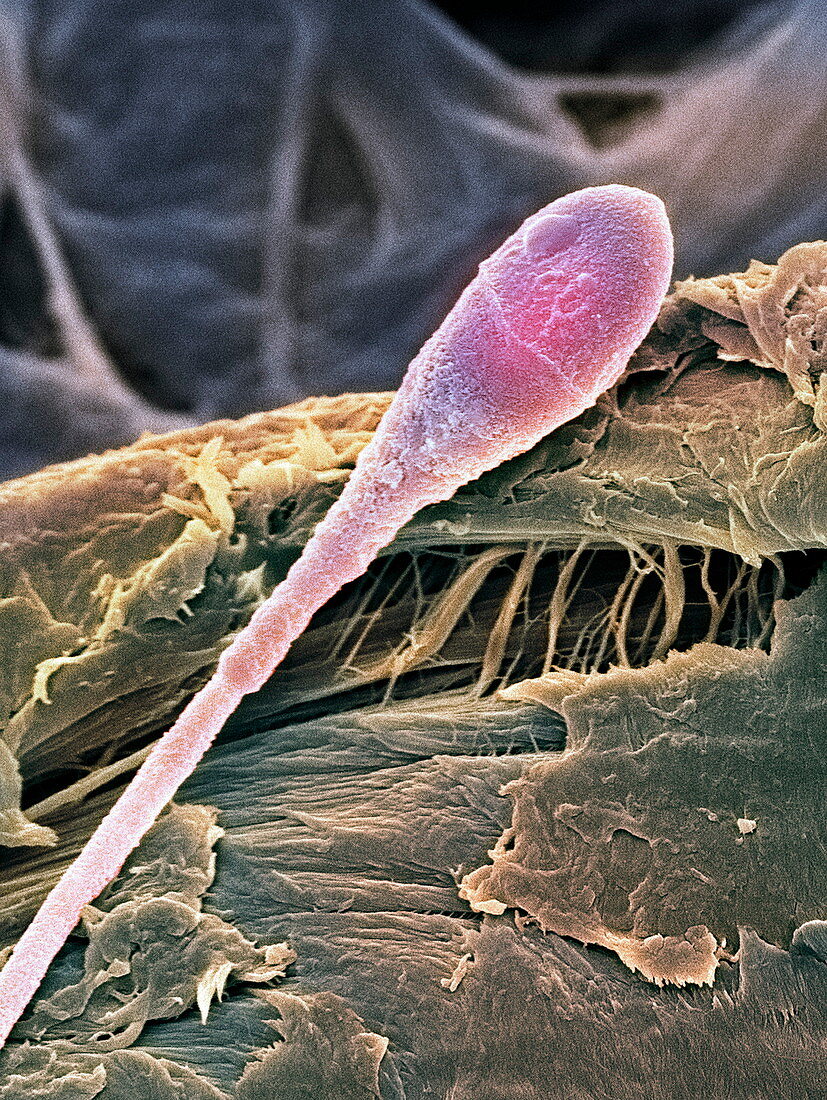 Sperm cell,SEM
