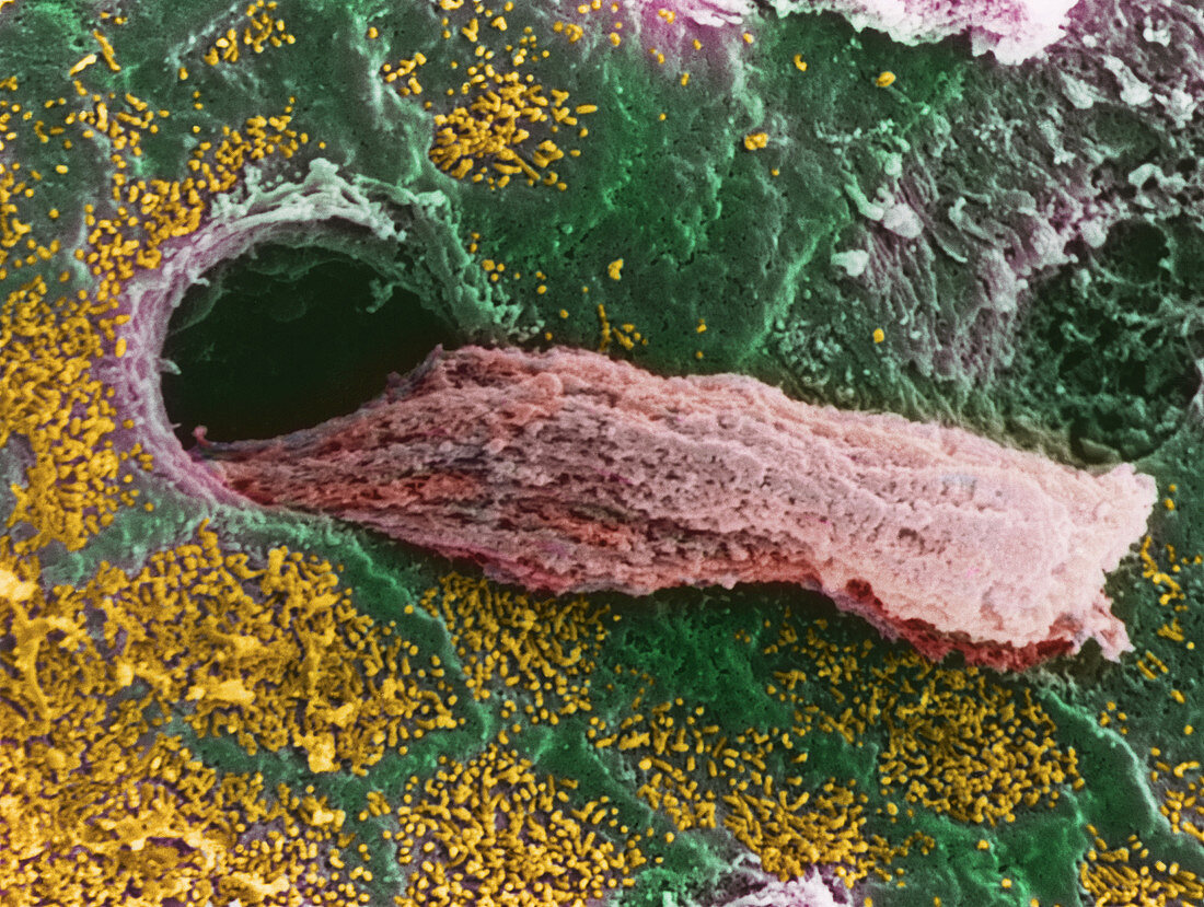 Coloured SEM of a secreting uterine gland