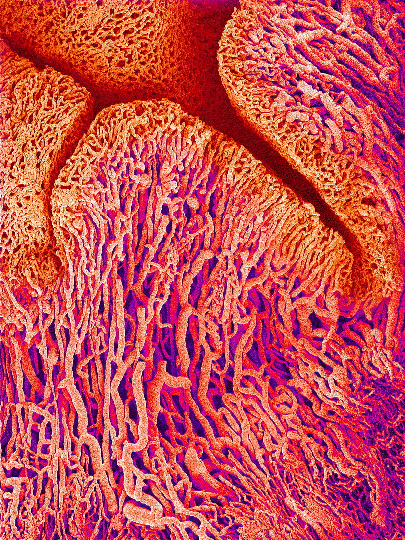 Fallopian tube blood vessels,SEM