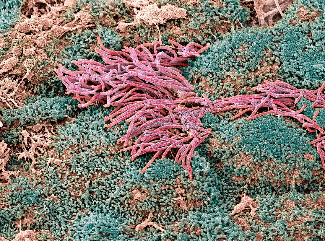 Cervical lining,SEM