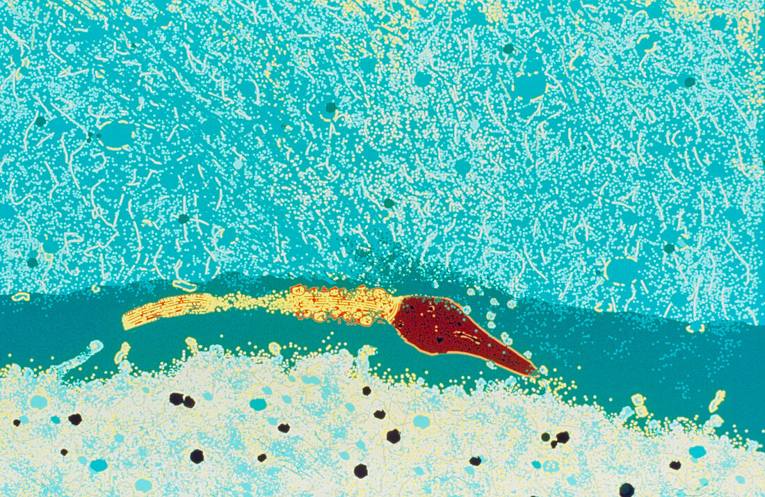 False-colour TEM of a human sperm penetrating ovum