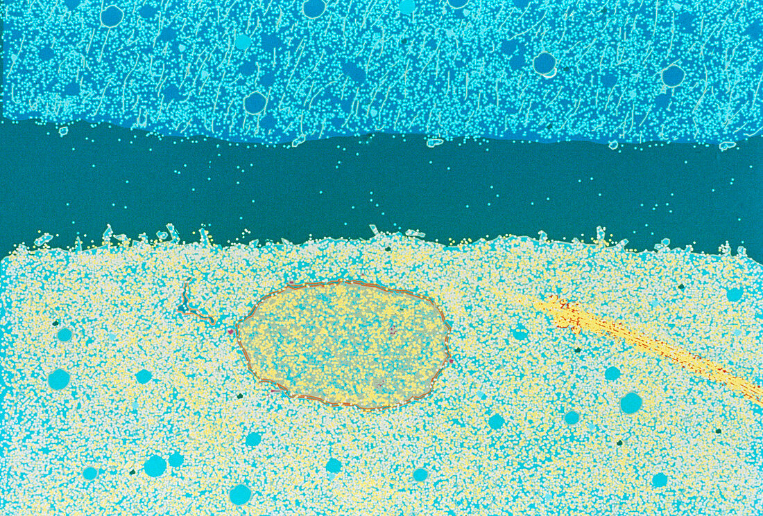 False-colour TEM of fertilisation of human oocyte