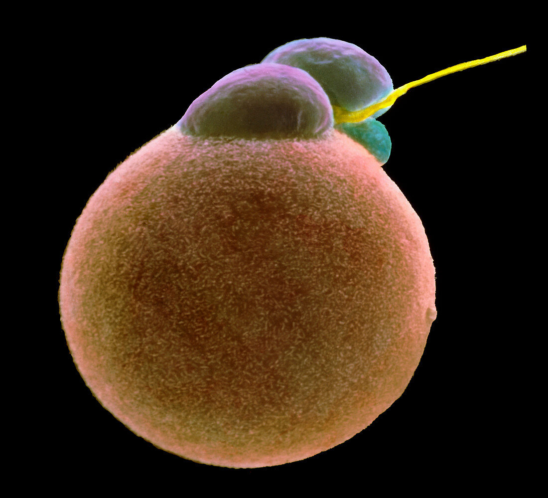 Coloured SEM of sperm fertilising an egg