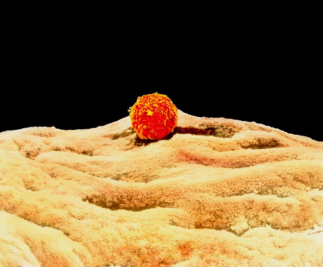 Coloured SEM of sperm on egg during fertilisation