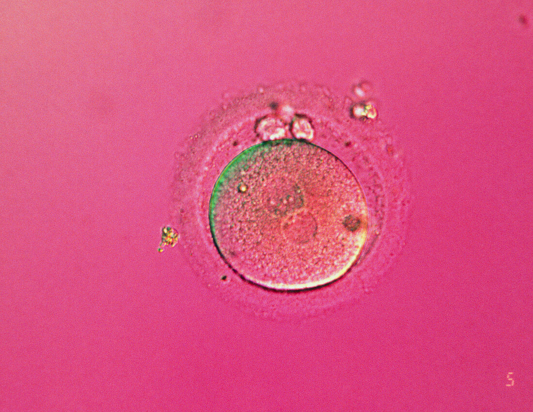 LM of human zygote during in-vitro fertilisation