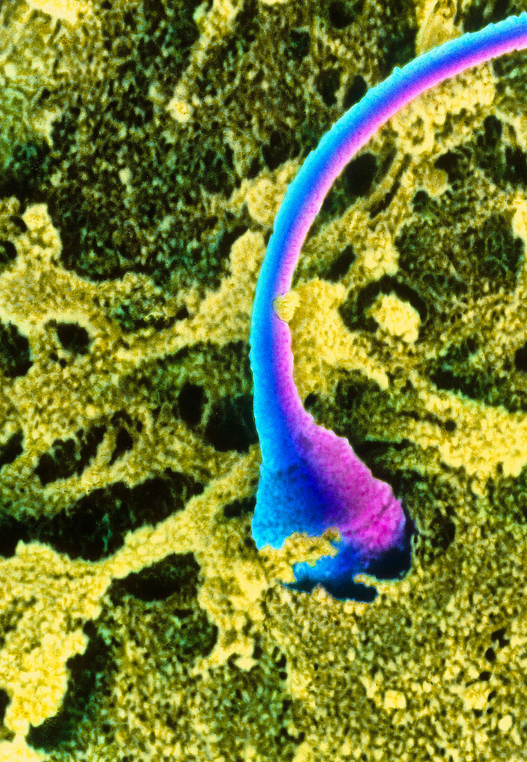 Coloured SEM of a human sperm entering an egg