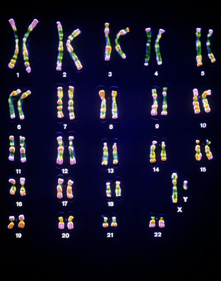 False-colour LM of a set of male chromosomes