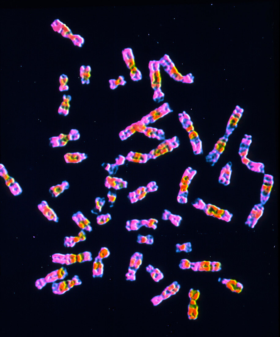 LM of human chromosomes from amniocentesis