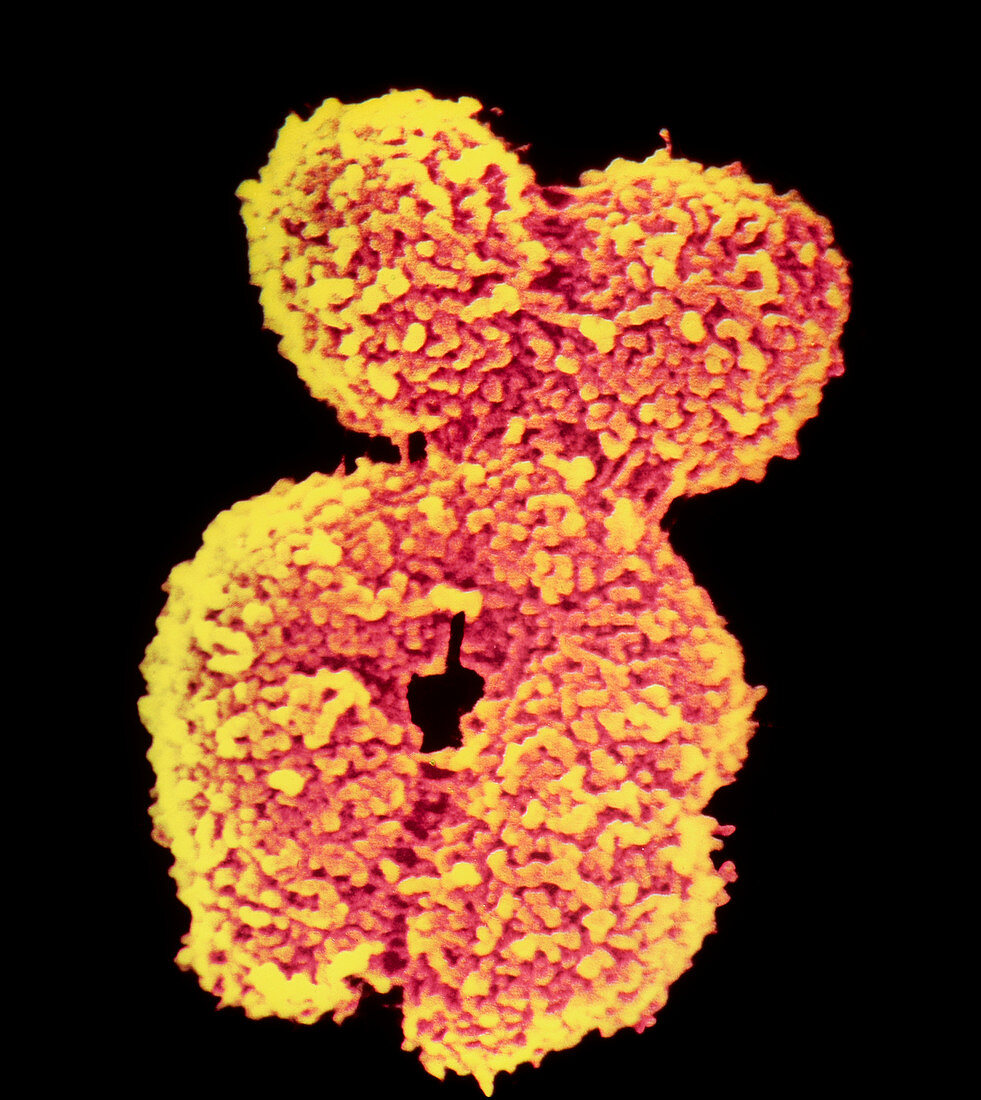 Coloured SEM of a single human chromosome