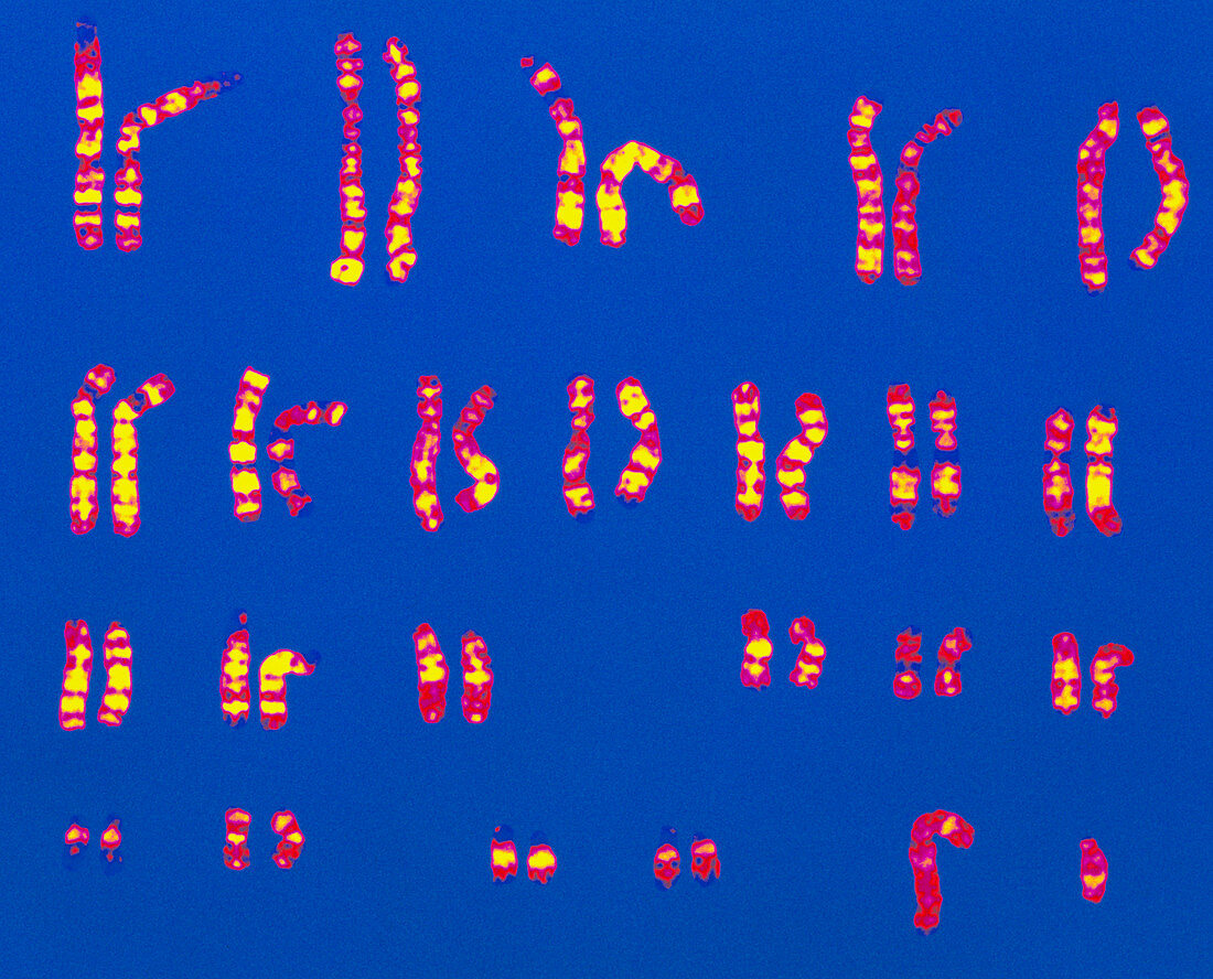 Coloured LM of a set of normal male chromosomes