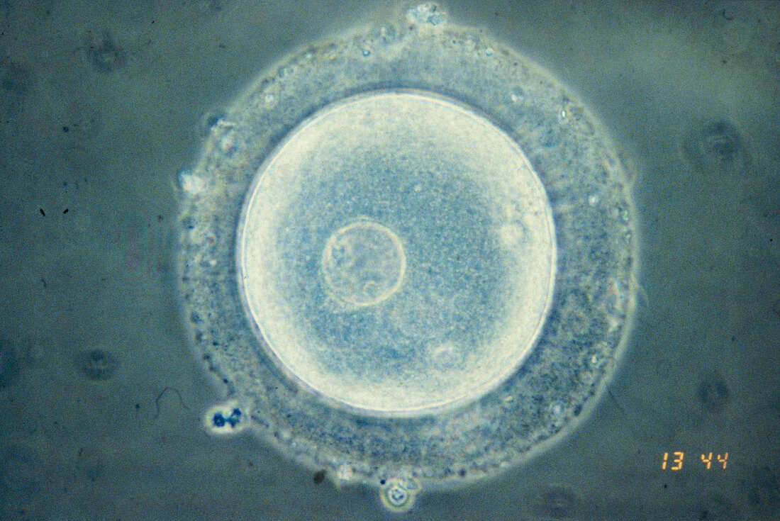 Immature human oocyte,light micrograph