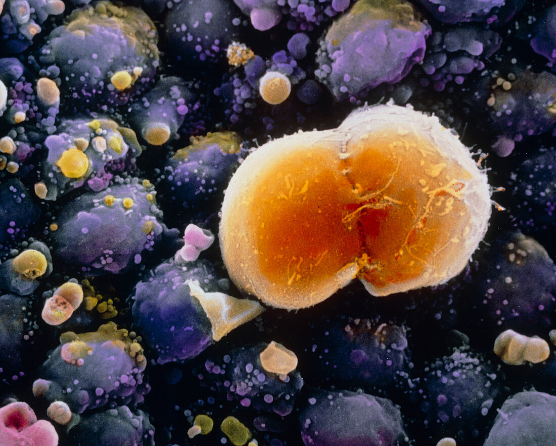 F. colour SEM of a dividing primordial germ cell