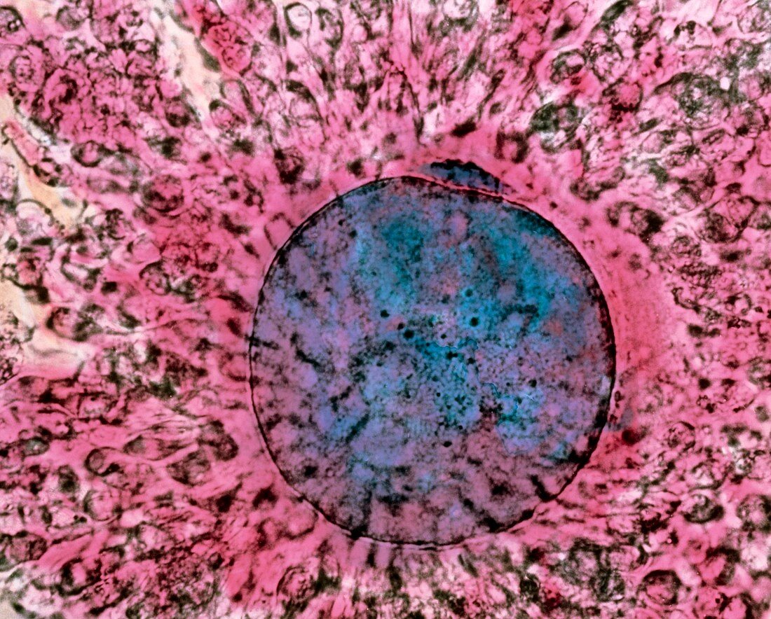 Coloured LM of mature human oocyte with polar body