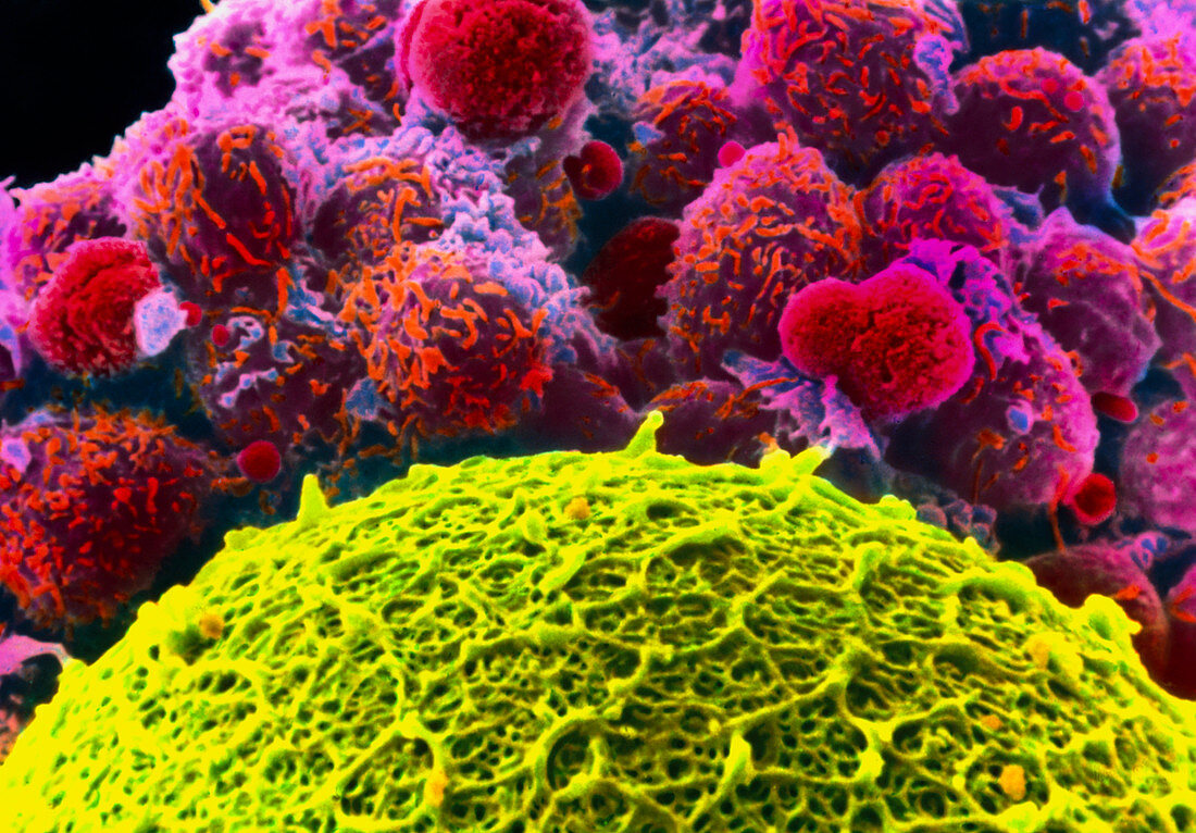 Colour SEM of human egg with corona radiata cells
